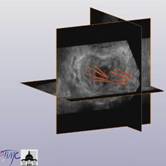 reconstruction3D
