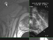 image-composite