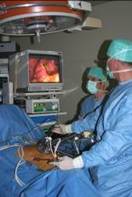 Cholecystectomy