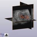 reconstruction3D