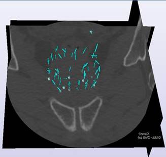 Figure19-CT9-right