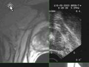 image-composite